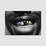 Golden Teeth