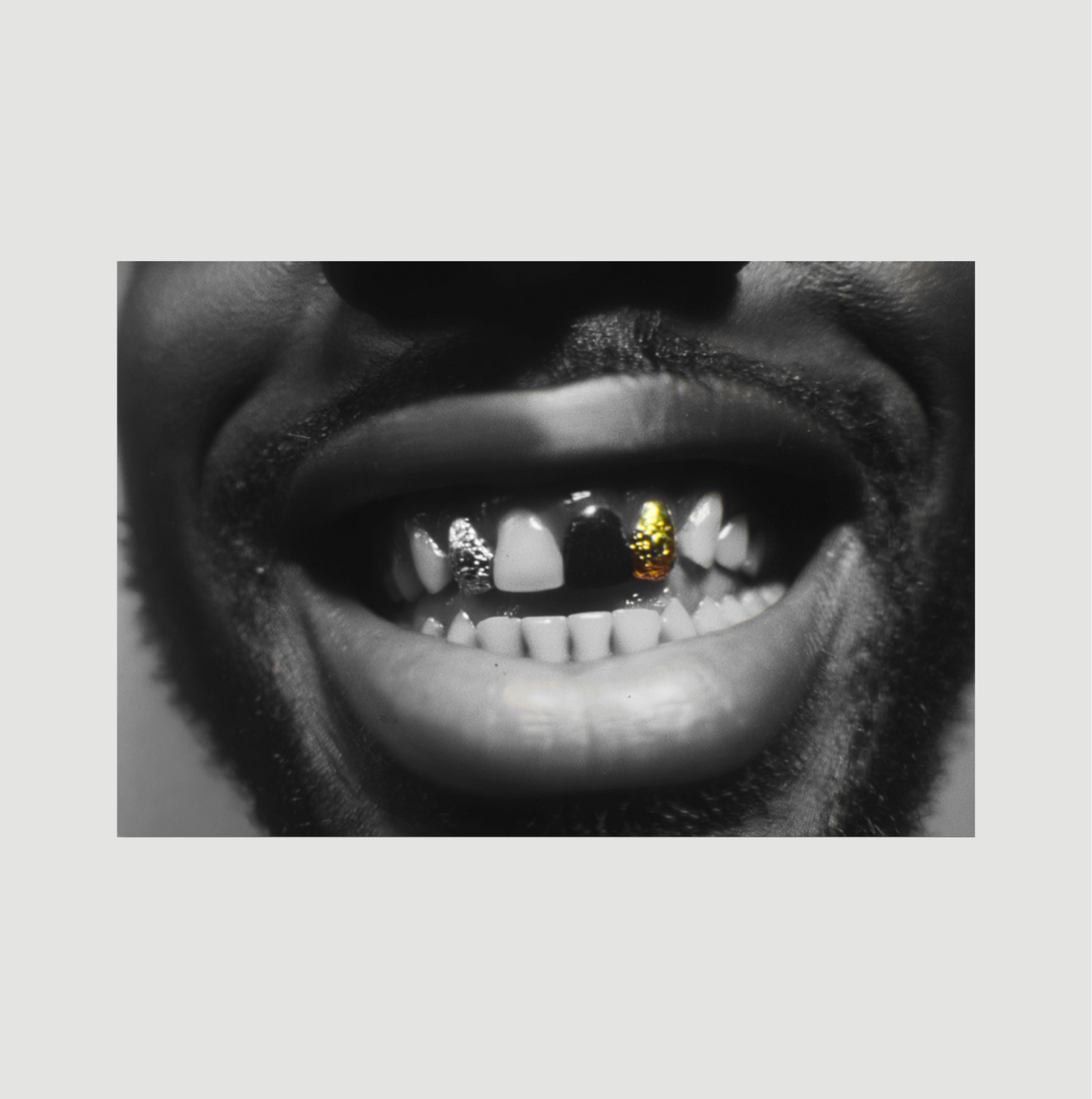Golden Teeth